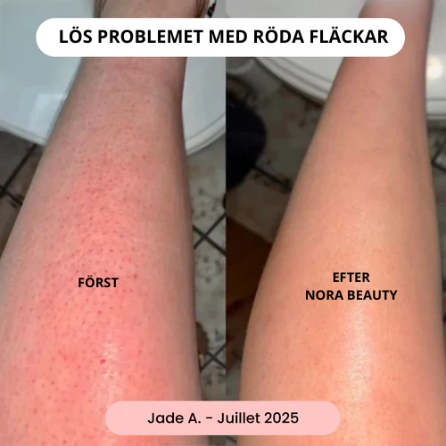 Nora Beauty™ - Intim rakning utan irritation